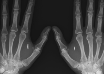 О «слитой базе данных вакцинированных»