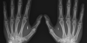 О «слитой базе данных вакцинированных»