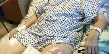 Экс-чемпиону отрезали ногу после прививки